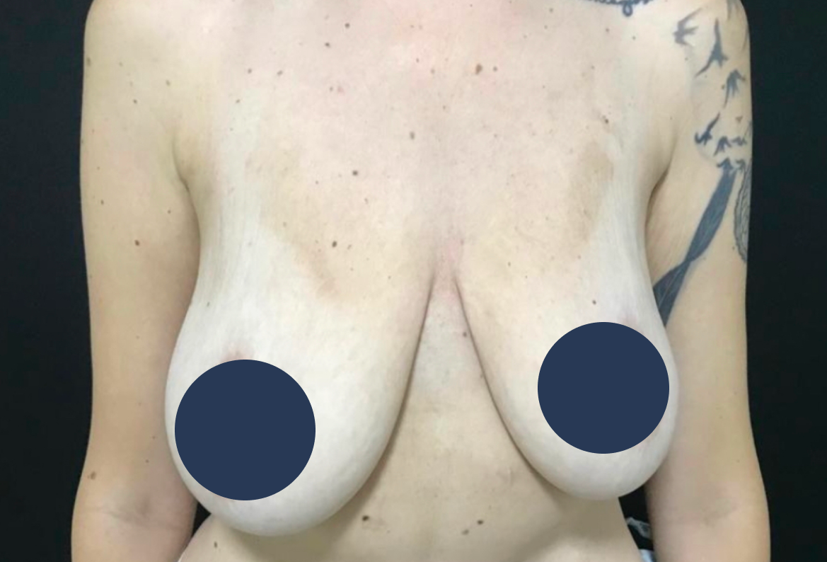 Antes